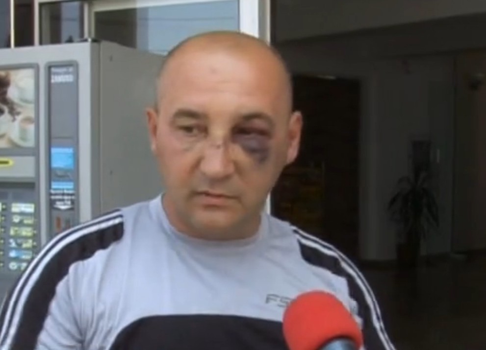 Хотелиер се би с деца в Черноморец