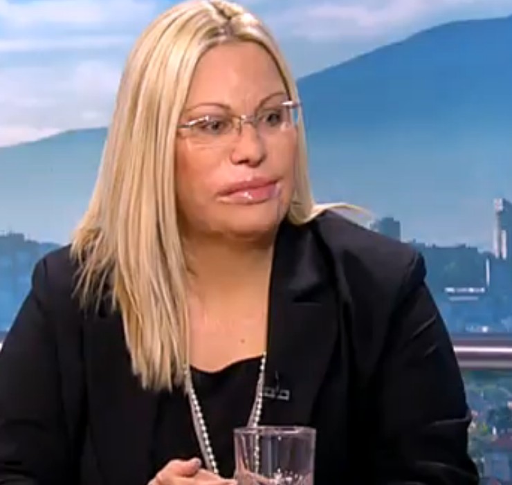 Залята с киселина Мария Бонева: Дойдох без грим, за да отправя послание към момичето с 400 шева