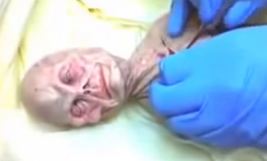 Сами ли сме: Разкриха секретна аутопсия на извънземно (ВИДЕО 18+) 