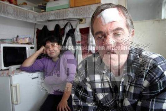 Човекът без лице се избави от тумора