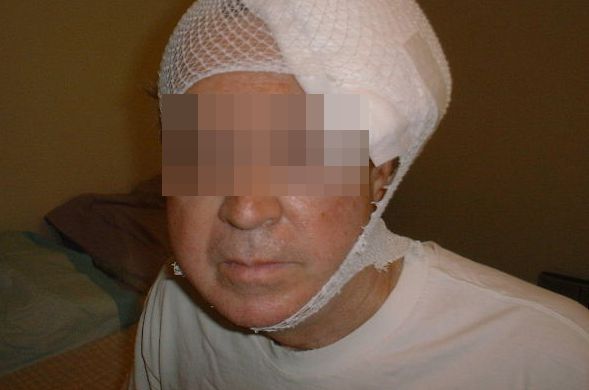 Пълен цирк! Натирена булка тръгна да си кърти дограмата, разцепиха главата на баща й