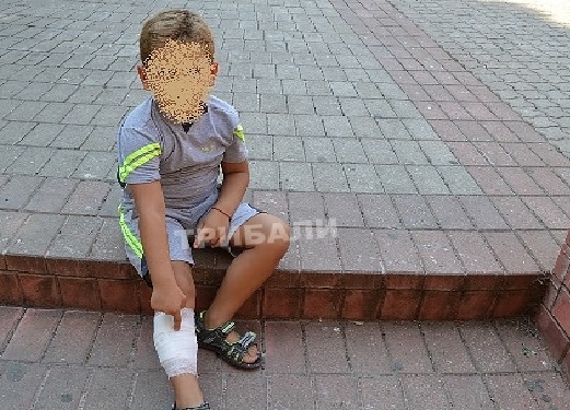 Помияри нахапаха дете в центъра на Враца, то крещи от болка и уплаха (СНИМКИ)