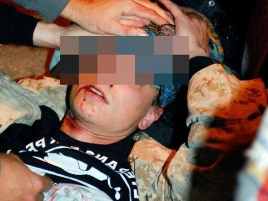 Семеен скандал: Тийнейджър нокаутира брат си с дядовата патерица