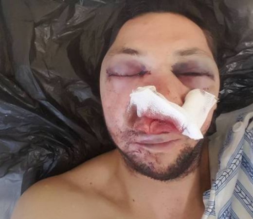 31-годишен помориец е задържан за побоя над журналиста Стоян Тончев