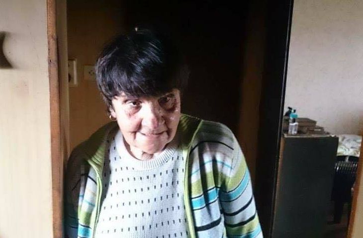 Ужасът в Пловдив: Баба Благодатка едва оцеля от огнен ад (СНИМКИ)