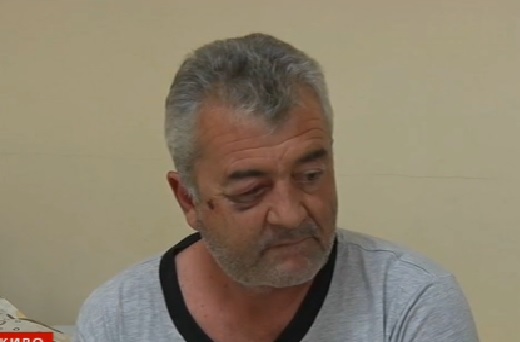 Шофьорът, пребит от курсант на МВР: Първо ме биха с юмруци, после ме ритаха (ВИДЕО)