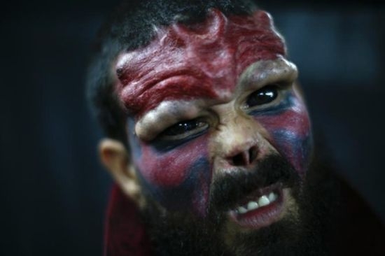 Фен на Red Skull си отряза носа, за да заприлича на него (БРУТАЛНИ СНИМКИ)