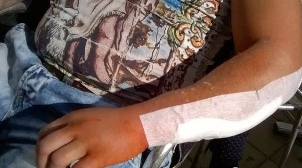 Раненият Димитър след кървавото меле в Сунгурларе: Десетки диваци от гетото дойдоха да ни трепят. Страшно е!