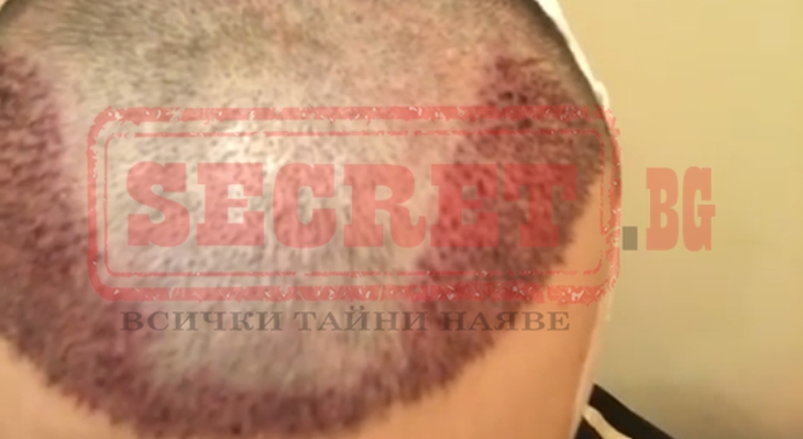 Крум се обезобрази! Вижте какво направи с главата си!