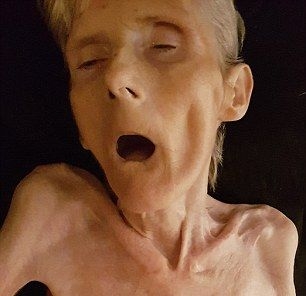 Семейство показа СНИМКИ на болна от МС майка в последните ѝ дни на „мъчение”