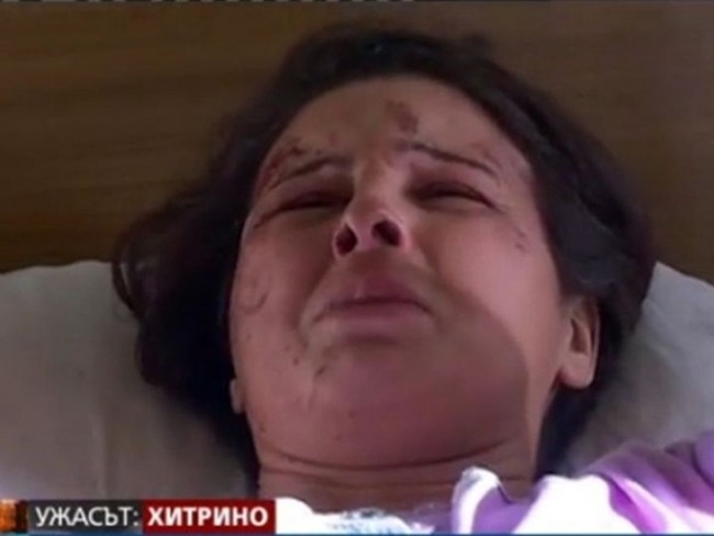 Адът в Хитрино напомни за себе си! Една от най-тежко пострадалите направи просълзяваща изповед