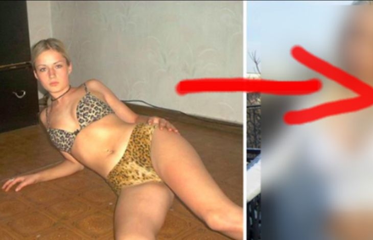 Тя премахна част от тялото си, за да сбъдне мечтата си. Вижте как изглежда днес, ще останете без думи (СНИМКИ 18+)