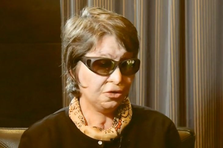 Залятата с киселина Константина Кунева проговори за най-кошмарния епизод в живота си