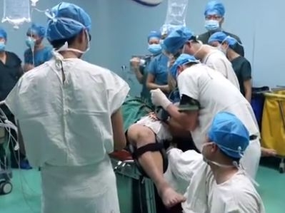 Уникална операция: Лекари отстраниха лагер от пениса на китаец (ВИДЕО)