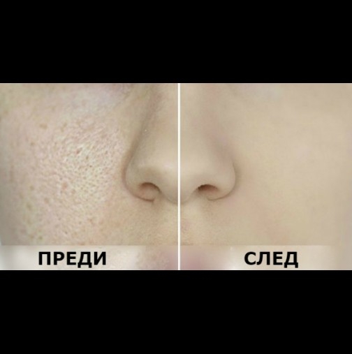 Тази маска ще направи лицето ви гладко като бебешко дупе  