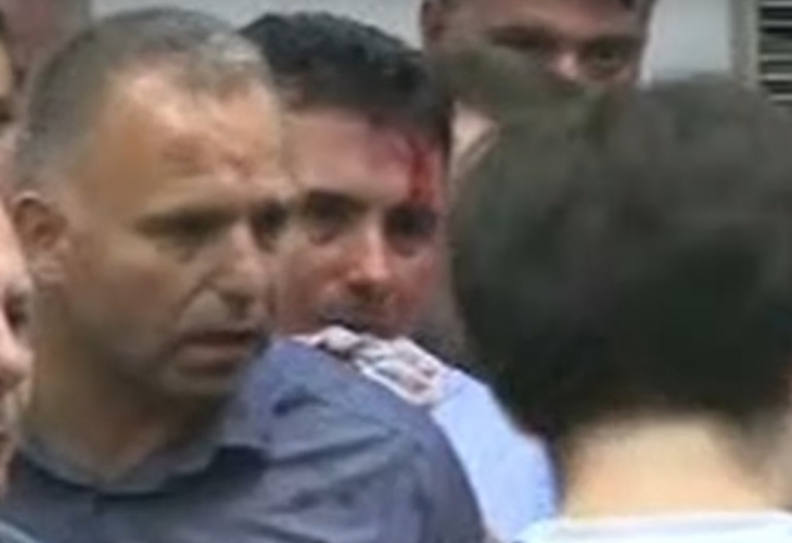 В Македония напрежението ескалира: Окървавеният Зоран Заев изригна мощно: Това бе опит за убийство!