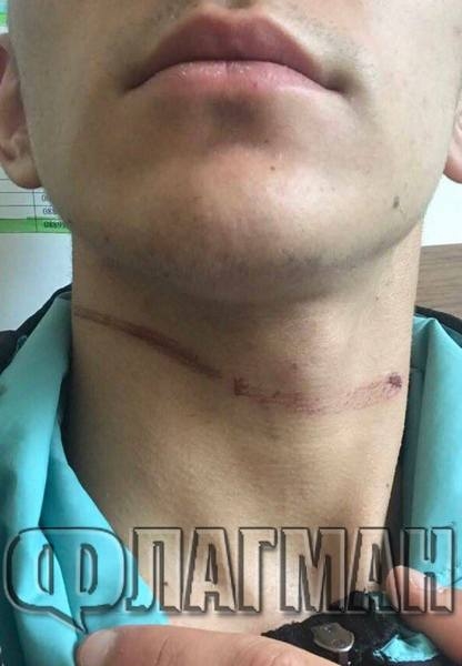 Майката на момчето, пребито от бургаски батки, направи шокиращи разкрития! (СНИМКИ 18+)