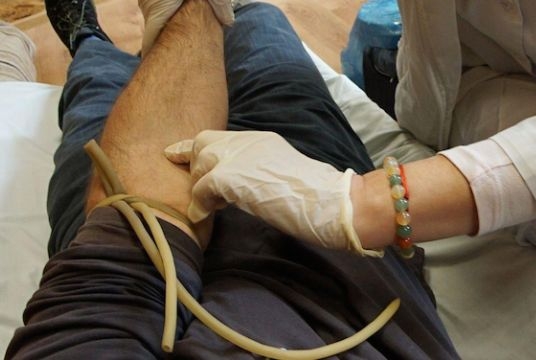 Тежко пострадалите работници от „Стомана“ имат нужда от кръв