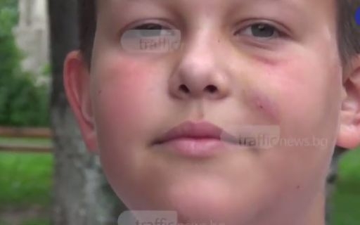 Питбул наръфа зверски хлапе в селски парк (СНИМКИ)