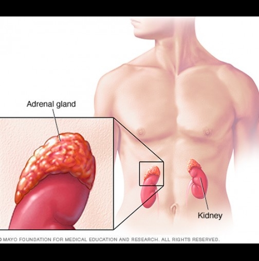 Когато надбъбречните жлези не функционират както трябва, ще имате ето тези проблеми