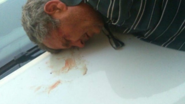Извънредно от Скопие! Стрелба и опит за убийство на министър при смяната на властта! (СНИМКИ/ВИДЕО)