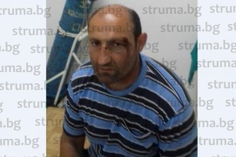 Роми клаха с коса мъж от Микрево, докато им пречи да му откраднат люцерната (СНИМКИ 18+)