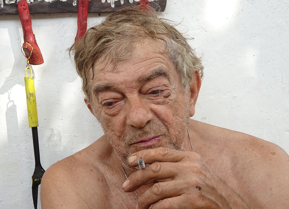 Николай Николаев: Лекарката ми изкрещя: Ако мръднеш, ще умреш