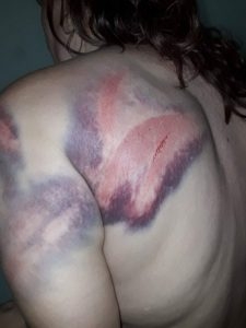 Брутално: Роми пребиха с бухалки и дървета майка и 14-годишната й дъщеря в монтанско село! (СНИМКИ/ВИДЕО 18+)