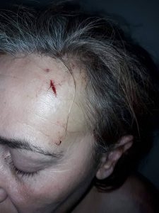 Брутално: Роми пребиха с бухалки и дървета майка и 14-годишната й дъщеря в монтанско село! (СНИМКИ/ВИДЕО 18+)