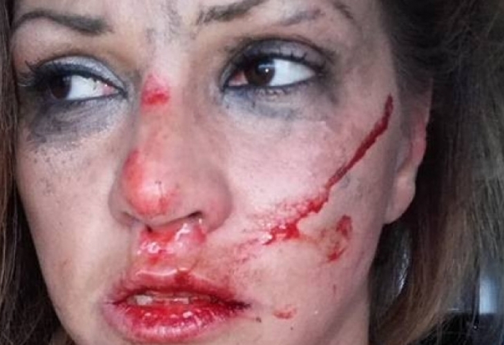 Битата като куче от швед Сани Алекса с нова порция разкрития за насилника си (ВИДЕО)