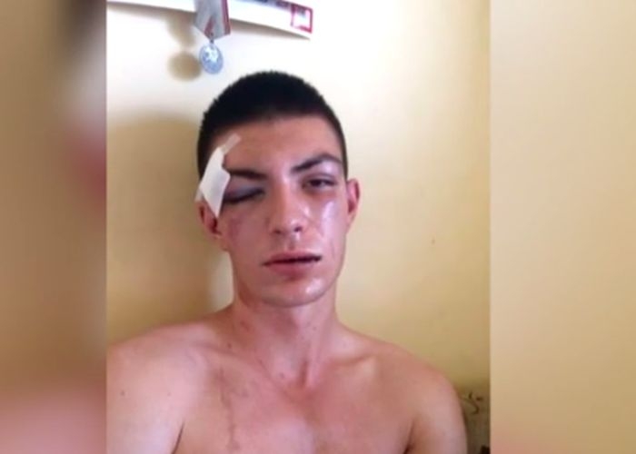 Изплуваха покъртителни подробности за зверски пребития в дискотека в "Студентски град" Мирослав (СНИМКИ)