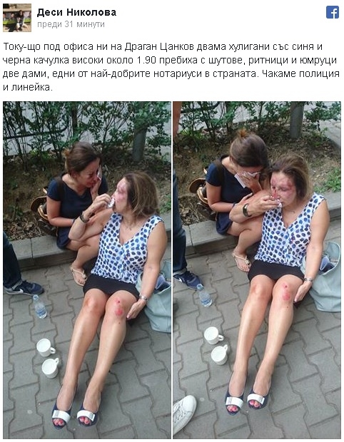 Ужас в Борисовата градина: Хулигани пребиха две жени посред бял ден (СНИМКИ)