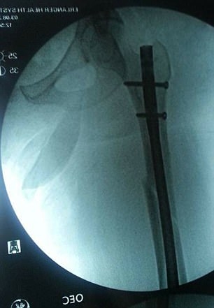 Тази ужасна история показва защо не трябва да си слагате краката на таблото на колата, докато пътувате (СНИМКИ)