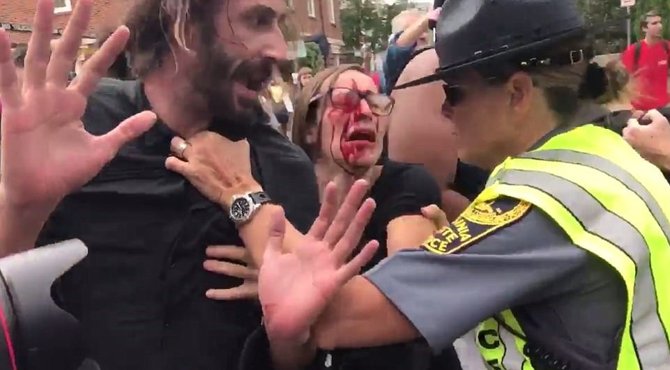 НА ЖИВО: Сблъсъци между крайнодесни и антирасисти окървавиха Вирджиния, кола се заби в протестиращите (СНИМКИ/ВИДЕО 18+)