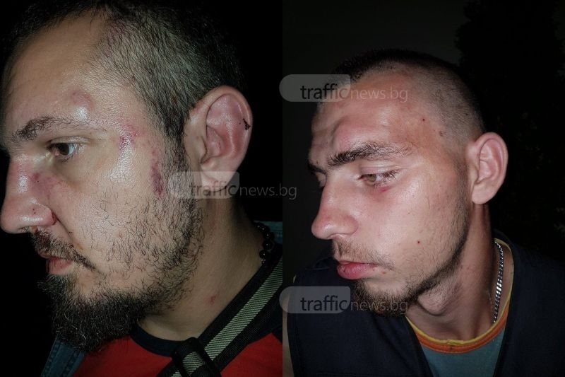 Ново безчинство: Тумба роми начело с Кальо Тарзана нападнаха с ножове и бутилки хората в заведение в село Дунавци (СНИМКИ)