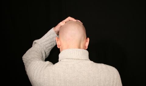Оплешивявате? Няма страшно! Откриха нов ефективен лек за този проблем