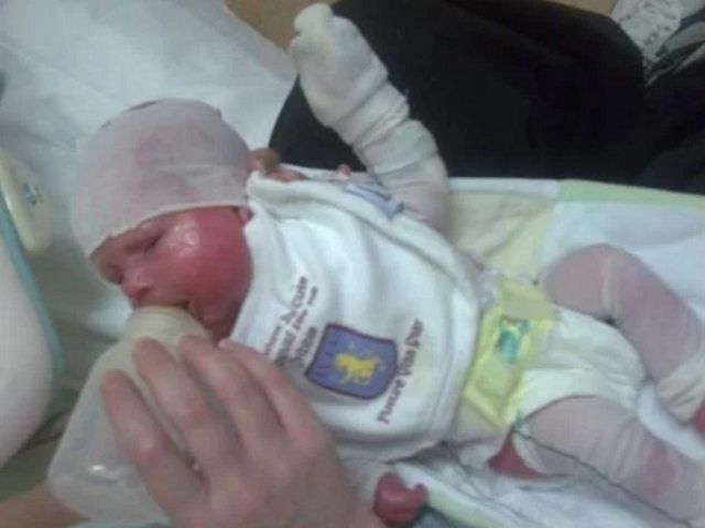 Тежка драма! 9-годишно момче се роди със страшна болест, цял живот го сочат с пръст и му се смеят, а то... (СНИМКИ)