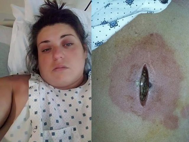 Млада жена: През нощта ме ухапа нещо като комар, а на сутринта бях на крачка от смъртта (СНИМКИ)