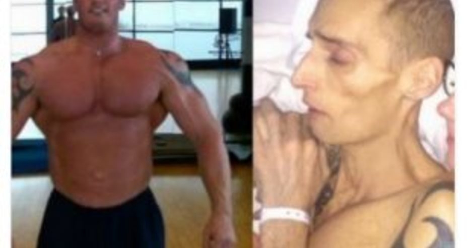 Тъжна гледка: Какво докара до това състояние амбициозен спортист и рак погуби живота му? Най-вероятно и вие го консумирате прекалено често