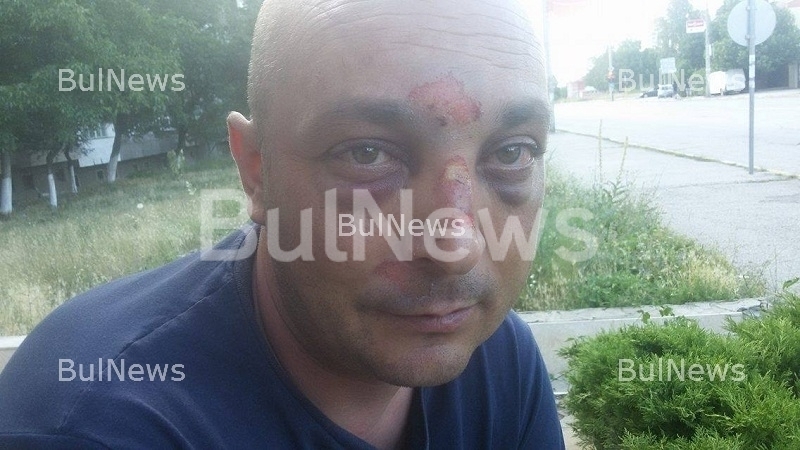 Паника: Мъж припадна пред магазин във Враца и от устата му започна да излиза пяна (СНИМКИ 18+)