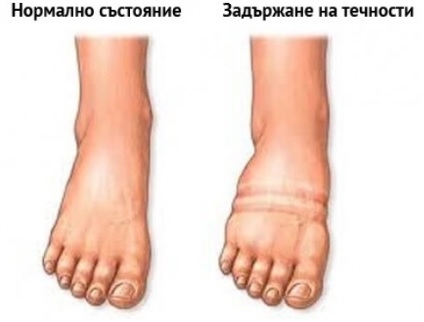 Ако задържате вода и дебелеете без причина, то ЗАДЪЛЖИТЕЛНО прочетете тези редове!