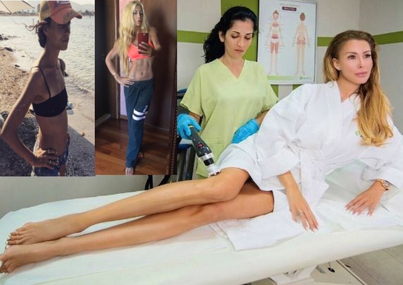 Радина и Венета Харизанова вече са живи скелети! Опасна диета изсмуква живота от родните випки