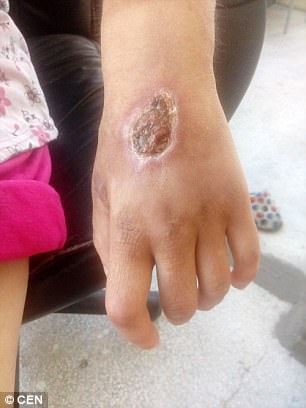 Ужасяващи СНИМКИ (18+): Българска секс робиня показва какво са направили с нея трафиканти на хора 
