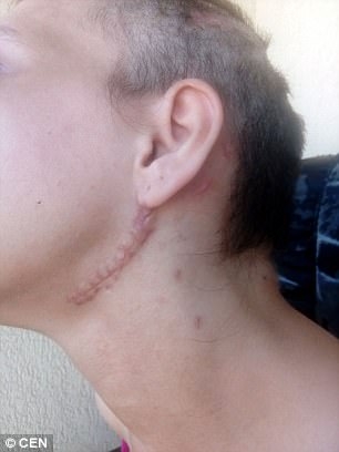 Ужасяващи СНИМКИ (18+): Българска секс робиня показва какво са направили с нея трафиканти на хора 