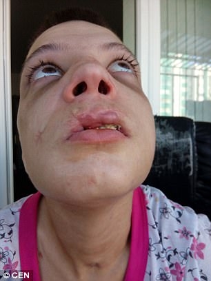 Ужасяващи СНИМКИ (18+): Българска секс робиня показва какво са направили с нея трафиканти на хора 
