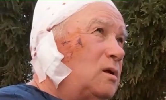 Дядо Ценко, който стана жертва на агресивен питбул, се прости с ухото си (СНИМКА)