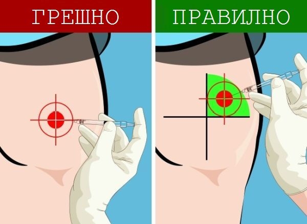 Ето как да сложите сами инжекция, ако ви се наложи спешно (СНИМКИ)