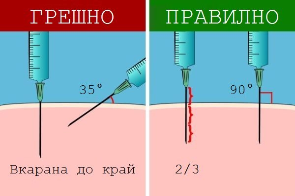 Ето как да сложите сами инжекция, ако ви се наложи спешно (СНИМКИ)