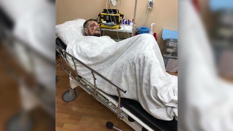 Взривиха радикалния депутат Игор Мосийчук, сбъдна ли се заканата на Рамзан Кадиров (СНИМКИ/ВИДЕО)