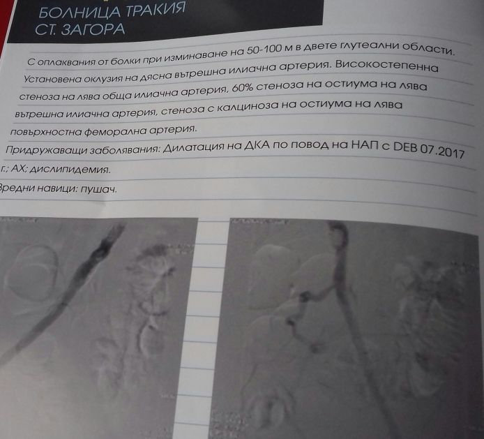 Кардиологичен форум в Пловдив показва минимално инвазивни сърдечни операции на живо (СНИМКИ)
